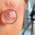 Dermatologia: jak rozpoznać choroby skóry i kiedy szukać pomocy?