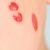 Kiedy podrażnienie skóry wymaga wizyty u dermatologa – objawy i bezpieczne kroki do podjęcia
