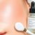 Retinol a peeling mechaniczny: jak bezpiecznie łączyć złuszczanie i uniknąć podrażnień skóry