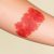 Kiedy rumień wymaga wizyty u dermatologa – sygnały, które warto obserwować i jak się przygotować do konsultacji